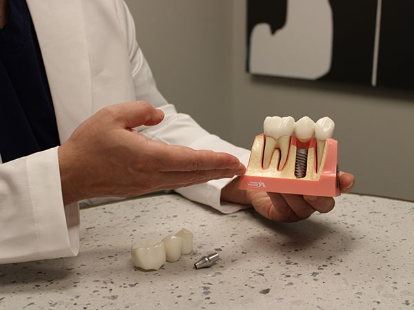 Tooth Replacement Options Leawood